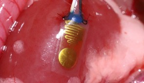 Implanted device on a rat kidney.
