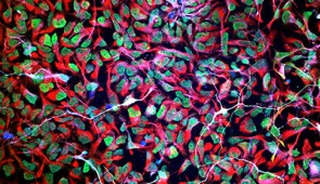 Human stem cells (red and green) treated with a therapeutic material that was modified to have a high degree of “supramolecular motion.” The cells began to differentiate into neurons (white) in the presence of the material.
