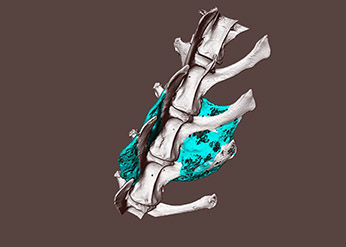 Spine illustration