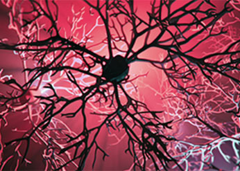 parkinson's disease