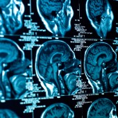 Brain protein tied to CTE not elevated in former amateur football players