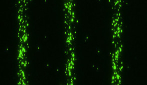 Extracellular vesicles bound to a surface to make 5-micron-wide trails.