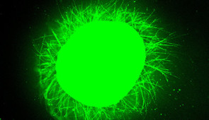 Fluorescent micrographs showing increased neurite outgrowth from a human spinal cord organoid treated with fast-moving “dancing molecules."