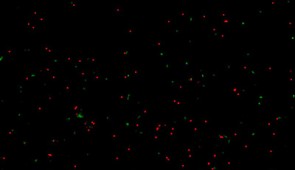 Micrograph of human neurons that were exposed to amyloid-beta proteins and not treated with the new therapy. Neurons in red are dead; living neurons are in green.