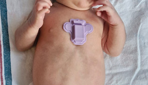 polygraph device on baby