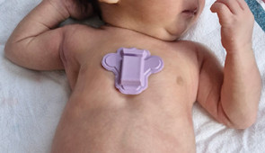 polygraph device on baby