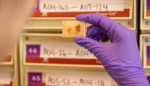 Brain samples are stored and examined in a variety of ways — here, small brain samples are fixed in blocks of wax. (Credit: Shane Collins, Northwestern University)