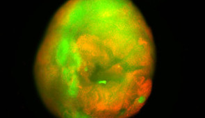 A fluorescent image of the human spinal cord organoid contusion model. Dead cells are red and live cells are green.