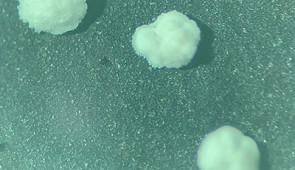 Electron microscopy image of microscopic foraminifera