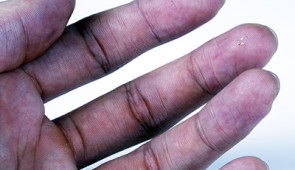 Microfliers on a finger tip