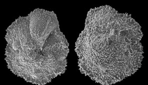 Scanning electron microscopy images of foraminifera from different angles