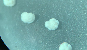 Electron microscopy image of microscopic foraminifera
