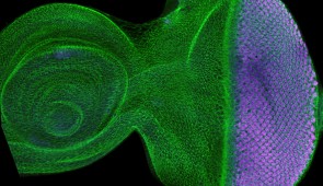 The developing fruit fly eye has a moving wave behind which cells self organize into a lattice pattern of photoreceptors (purple). Credit R. Carthew