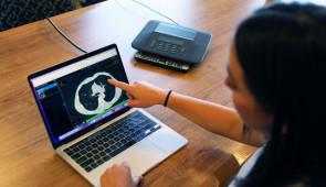 Dr. Gabrielle Liu points at a CT scan.
