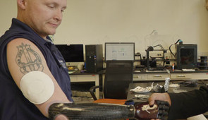 Retired U.S. Army Sgt. Garrett Anderson shakes a hand while wearing Northwestern's epidermal VR patch on his upper arm. The patch is integrated with his prosthetic arm to give more sensory feedback when holding an object.