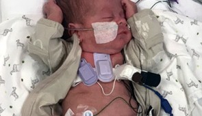 Wearable devices capture sounds inside a premature baby's lungs. Credit: Montreal Children's Hospital