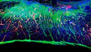 Longitudinal spinal cord section treated with the most bioactive therapeutic scaffold, captured 12 weeks after injury. Blood vessels (red) regenerated within the lesion. Laminin is stained in green and cells are stained in blue.