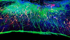 Longitudinal spinal cord section treated with the most bioactive therapeutic scaffold, captured 12 weeks after injury. Blood vessels (red) regenerated within the lesion. Laminin is stained in green and cells are stained in blue. 