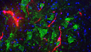 Motor neurons (green) and blood vessels (red) in the center of the lesion.