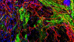 Regenerated axons (red) and glial cells (green) in the center of the lesion.  