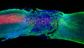 Longitudinal spinal cord section treated with the most bioactive therapeutic scaffold. Regenerated axons (red) regrew within the lesion.