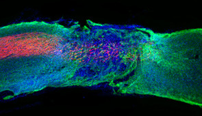 Longitudinal spinal cord section treated with the most bioactive therapeutic scaffold. Regenerated axons (red) regrew within the lesion.