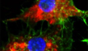 A microscopy image that shows SNAs (in red) taken up into leukemia cells.