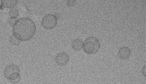 SNAs under a cryogenic electron microscope.