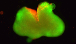 A fluorescent image of the human spinal cord organoid laceration model. Dead cells are red and live cells are green.