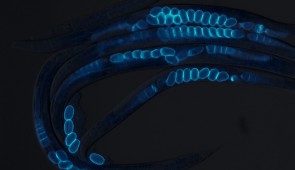 The transparent roundworm C. elegans that was used in this study.