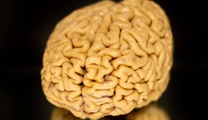 A donated SuperAger brain. (Credit: Shane Collins, Northwestern University)