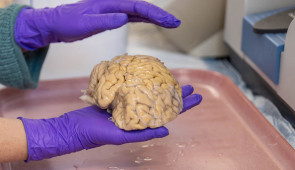 A lab member holds a donated SuperAger brain. (Credit: Shane Collins, Northwestern University)
