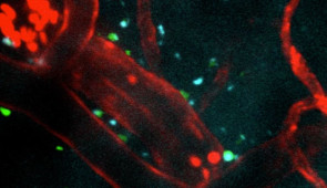 This video shows, in real time within the first 24 hours of the injection, immune cells (shown in red) rushing into an area injured by ischemic stroke. The peptide treatment (blue) successfully crosses the blood-brain barrier (red). Microglia (green) become active and surround the treatment, which indicates an elevated immune response. Recorded over five minutes and sped up here 60x. (Credit: Northwestern University)