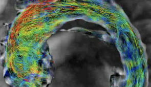 Watch blood flow through an aorta via a 4D flow MRI scan. Credit: Ethan Johnson