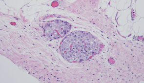 This images shows transplanted islets (darker purple) and the blood vessels (the red/dark pink areas are blood cells inside the blood vessels).