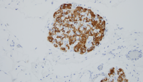 This histological image shows the presence of insulin within the islets (brown stain).