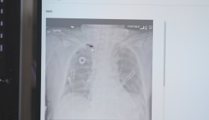 Dr. Abboud explains how the AI software works