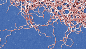 This digitally colorized scanning electron microscopic (SEM) image depicts a grouping of numerous, Gram-negative, anaerobic, Borrelia burgdorferi bacteria, derived from a pure culture. This pathogenic organism is responsible for causing Lyme disease, a zoonotic, vector-borne ailment, transmitted to humans through a tick bite.