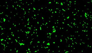 Micrograph of human neurons exposed to amyloid-beta proteins and treated with the new nanotherapy. Neurons in green are living.