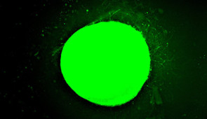 Fluorescent micrographs showing a human spinal cord organoid treated with slow-moving "dancing molecules." Neurite outgrowth is much more subdued, compared to the organoid treated with the fast-moving molecules.