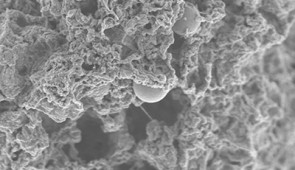 An SEM image of the nanoparticle (small sphere in center) inside a mast cell.