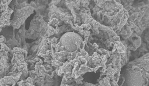 An SEM image of the nanoparticles (small spheres) inside of a mast cell.