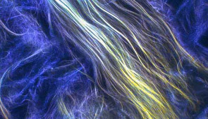 Confocal image of superstructure bundle