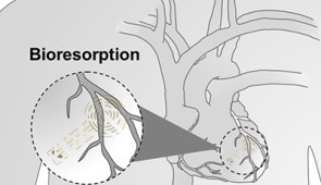 Illustrated comparison of current technology versus the new transient technology