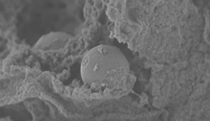 An SEM image showing a close-up look at a nanoparticle (sphere in center) inside a mast cell.
