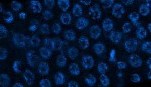 A magnified view of the part of the gonad where oocyte precursor cells are made.