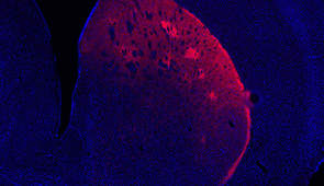 Microscopy image of a dopamine neuron subtype that displays activity correlated to locomotion but no response to rewards.