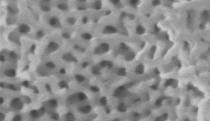 By increasing the magnification of the scanning electron microscopy image, researchers discovered a nanoscale, spongey architecture. Credit: Maria Kokkori/Northwestern University