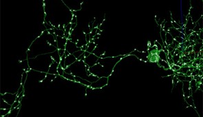 Electron microscopy (left) image of a single slice through the fly hemibrain sample. A single neuron is highlighted in green. Zoomed in EM image (right, top) of the region in the green box in the left figure, highlighting how a 3D neuron will cross a single plane in the brain many times. 3D reconstruction (right, bottom) of the highlighted neuron. Credit: Harvard University/Google