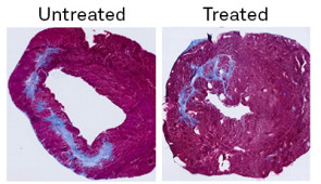 Samples of heart tissue from the study. The sample on the right, which was treated with the PLP therapy, shows decreased scarring (in blue) compared to the untreated sample on the left.